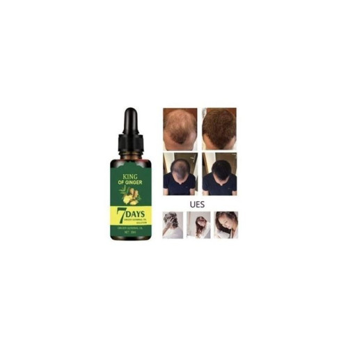 7 Days Bald Head Hair Restoration Ginger Germinal Oil